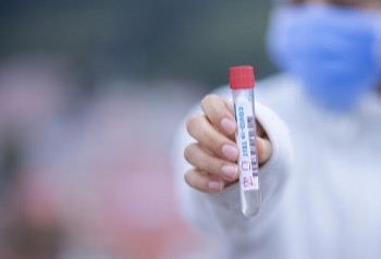 К сети «Гемотест» за месяц присоединилось 16 франчайзинговых отделений